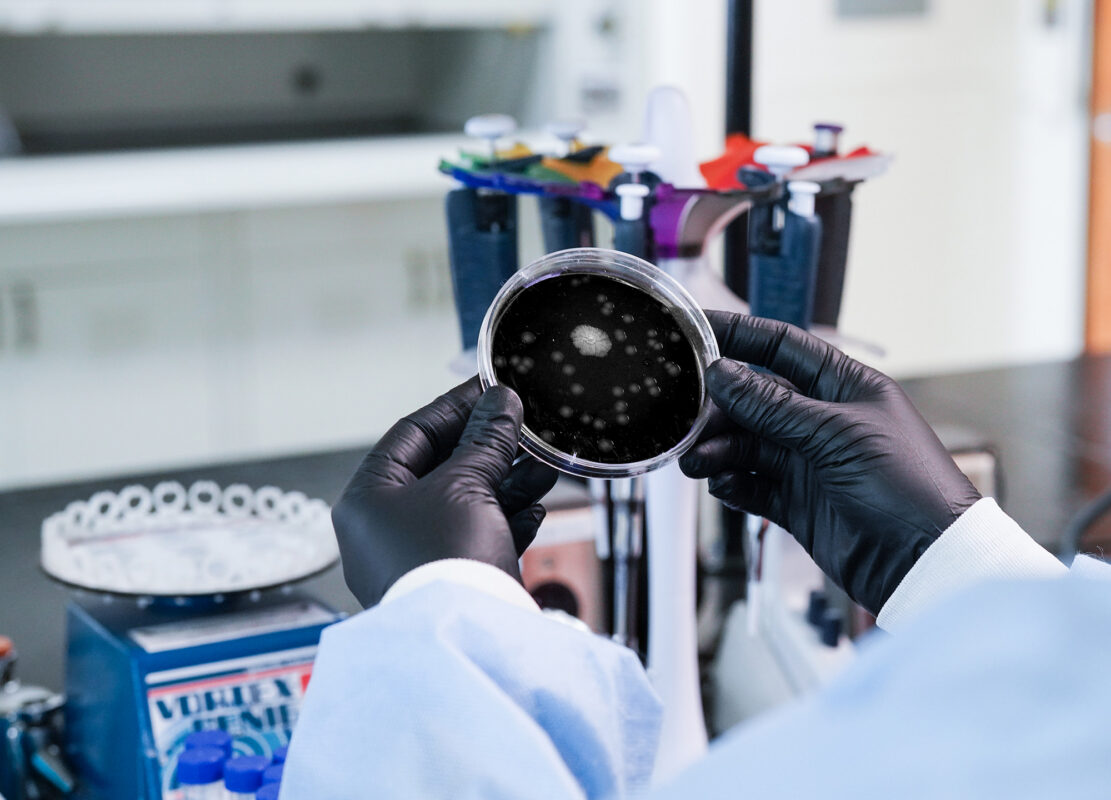 ISO Spread Plate test